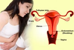 4 nguyên nhân gây viêm tử cung